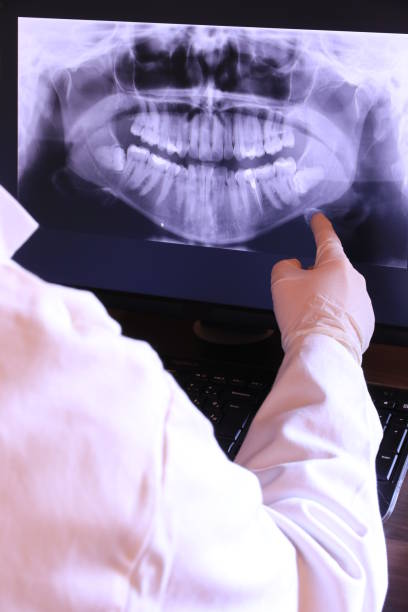 Best Emergency Tooth Extraction in Spokane, WA